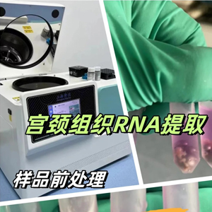 從 0 到 1 教你!冷凍研磨儀處理宮頸組織樣品的正確知識(shí)